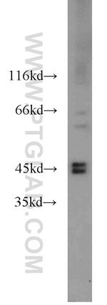 FBXO5 Antibody in Western Blot (WB)