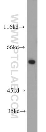 FBXO5 Antibody in Western Blot (WB)