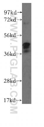 FBXO5 Antibody in Western Blot (WB)