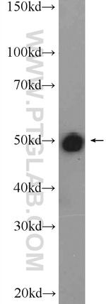 FBXO5 Antibody in Western Blot (WB)