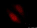 PITX1 Antibody in Immunocytochemistry (ICC/IF)