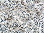 PITX1 Antibody in Immunohistochemistry (Paraffin) (IHC (P))