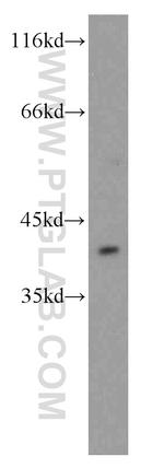 PITX1 Antibody in Western Blot (WB)
