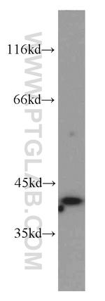 PITX1 Antibody in Western Blot (WB)