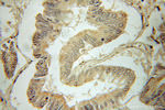 PRELID1 Antibody in Immunohistochemistry (Paraffin) (IHC (P))