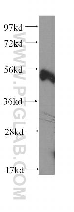 CD58 Antibody in Western Blot (WB)