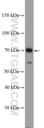 CD58 Antibody in Western Blot (WB)