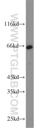 CD58 Antibody in Western Blot (WB)