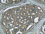 GAMT Antibody in Immunohistochemistry (Paraffin) (IHC (P))