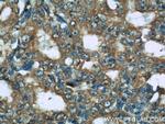 GAMT Antibody in Immunohistochemistry (Paraffin) (IHC (P))