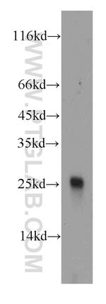 GAMT Antibody in Western Blot (WB)