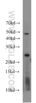 GAMT Antibody in Western Blot (WB)