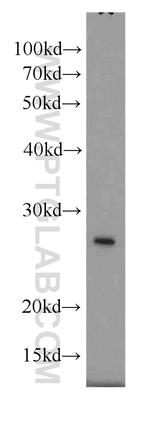GAMT Antibody in Western Blot (WB)