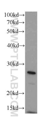 GAMT Antibody in Western Blot (WB)