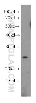 GAMT Antibody in Western Blot (WB)