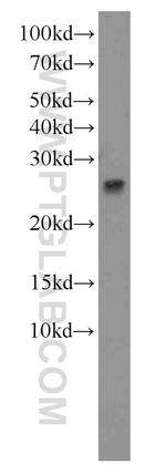 GAMT Antibody in Western Blot (WB)