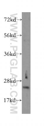 GAMT Antibody in Western Blot (WB)