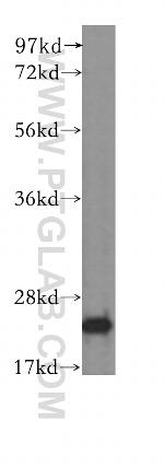 GAMT Antibody in Western Blot (WB)