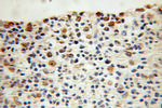 P16-INK4A Antibody in Immunohistochemistry (Paraffin) (IHC (P))