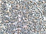 P16-INK4A Antibody in Immunohistochemistry (Paraffin) (IHC (P))