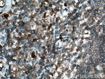 P16-INK4A Antibody in Immunohistochemistry (Paraffin) (IHC (P))