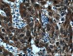 P16-INK4A Antibody in Immunohistochemistry (Paraffin) (IHC (P))