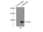 P16-INK4A Antibody in Immunoprecipitation (IP)