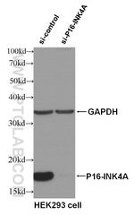 P16-INK4A Antibody in Western Blot (WB)