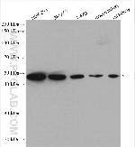 ETF1 Antibody in Western Blot (WB)