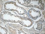 ETF1 Antibody in Immunohistochemistry (Paraffin) (IHC (P))