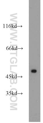 ETF1 Antibody in Western Blot (WB)