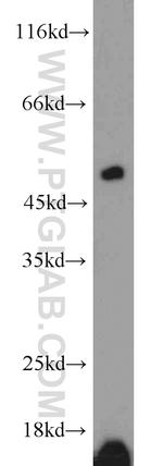 ETF1 Antibody in Western Blot (WB)