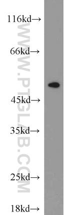 ETF1 Antibody in Western Blot (WB)