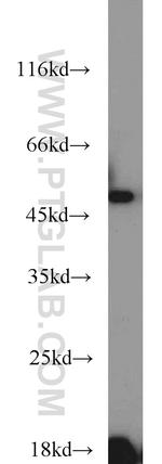 ETF1 Antibody in Western Blot (WB)