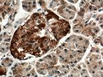CNKSR1 Antibody in Immunohistochemistry (Paraffin) (IHC (P))