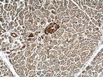 CNKSR1 Antibody in Immunohistochemistry (Paraffin) (IHC (P))