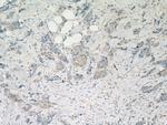 CNKSR1 Antibody in Immunohistochemistry (Paraffin) (IHC (P))