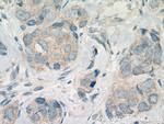 CNKSR1 Antibody in Immunohistochemistry (Paraffin) (IHC (P))