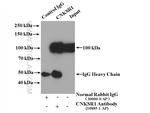 CNKSR1 Antibody in Immunoprecipitation (IP)
