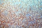 PPT1 Antibody in Immunohistochemistry (Paraffin) (IHC (P))