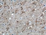 NPTX2 Antibody in Immunohistochemistry (Paraffin) (IHC (P))
