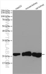 CSRP2 Antibody in Western Blot (WB)