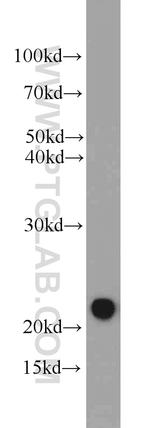 CSRP2 Antibody in Western Blot (WB)