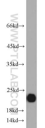 CSRP2 Antibody in Western Blot (WB)