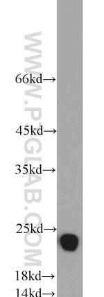 CSRP2 Antibody in Western Blot (WB)