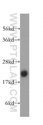 CSRP2 Antibody in Western Blot (WB)
