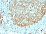 MALT1 Recombinant Mouse Monoclonal Antibody (rMT1, 410)