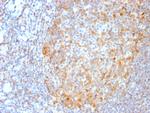 MALT1 Recombinant Rabbit Monoclonal Antibody (MT1, 3159R)