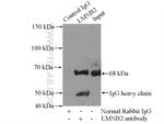 LMNB2 Antibody in Immunoprecipitation (IP)