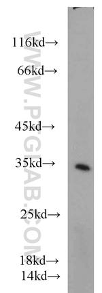 Cyclin G Antibody in Western Blot (WB)
